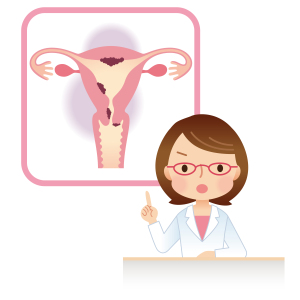 懷孕了喫什麼藥可以打掉孩子？